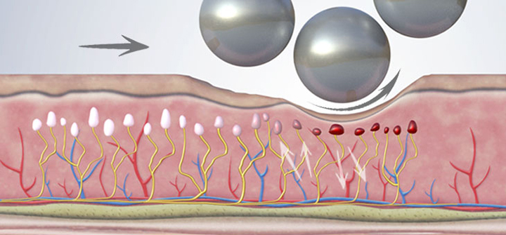 analgesic-action